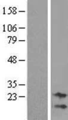 Western Blot: NRK1 Overexpression Lysate [NBL1-08607]