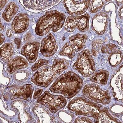 Immunohistochemistry-Paraffin: NRN1L Antibody [NBP1-92176]