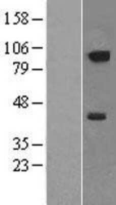 Western Blot: Neuropilin-2 Overexpression Lysate [NBL1-13801]