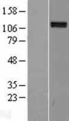 Western Blot: Neuropilin-2 Overexpression Lysate [NBL1-13802]