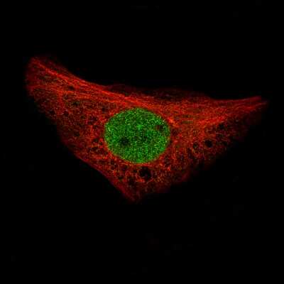 Immunocytochemistry/ Immunofluorescence: NRSF Antibody (CL0381) [NBP2-42048]