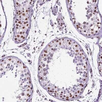 Immunohistochemistry-Paraffin: NRSF Antibody (CL0381) [NBP2-42048]