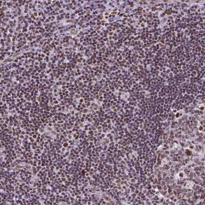 Immunohistochemistry-Paraffin: NRSF Antibody (CL0381) [NBP2-42048]