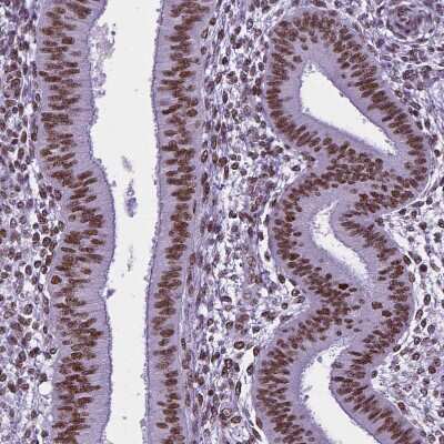 Immunohistochemistry-Paraffin: NRSF Antibody (CL0381) [NBP2-42048]