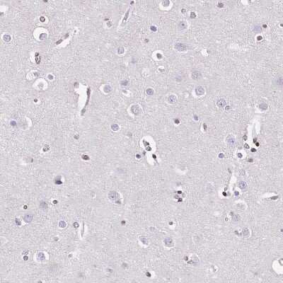 Immunohistochemistry-Paraffin: NRSF Antibody (CL0381) [NBP2-42048]