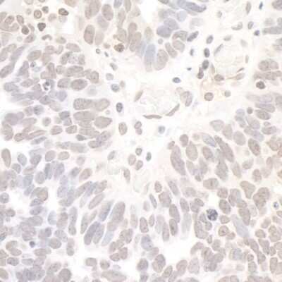 Immunohistochemistry-Paraffin: NRSF Antibody [NB100-756]