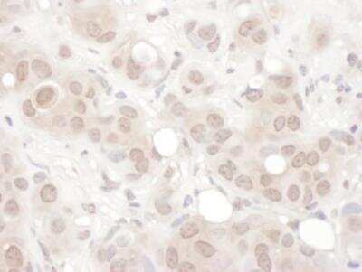 Immunohistochemistry-Paraffin: NRSF Antibody [NB100-757]