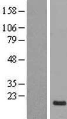 Western Blot: NRSN1 Overexpression Lysate [NBL1-13804]