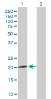 Western Blot: NRSN2 Antibody [H00080023-B01P]