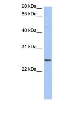 Western Blot: NRSN2 Antibody [NBP1-59831]