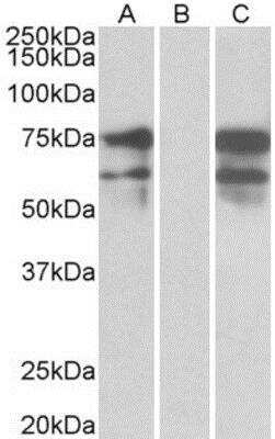 Western Blot: NRXN1 Antibody [NBP1-00219]