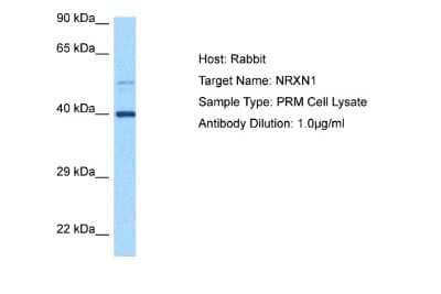 Western Blot: NRXN1 Antibody [NBP2-87932]