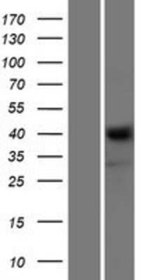 Western Blot: NRXN1 Overexpression Lysate [NBL1-13805]