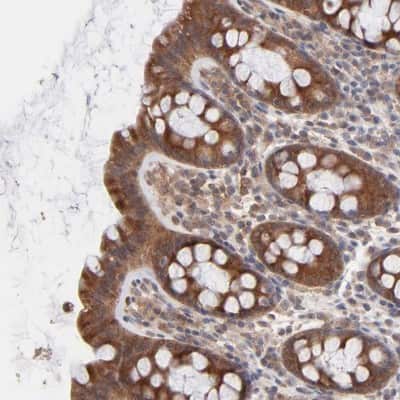 Immunohistochemistry-Paraffin: NS1-BP Antibody [NBP1-83180]
