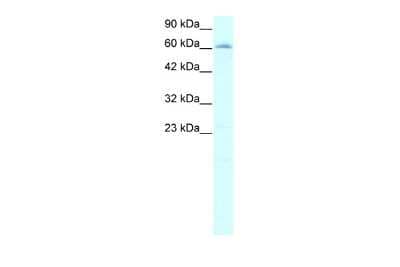 Western Blot: NS1-BP Antibody [NBP2-85403]