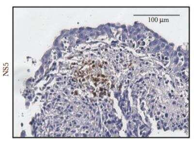 Immunohistochemistry-Paraffin: Dengue Virus NS5 Antibody [NBP2-42900]
