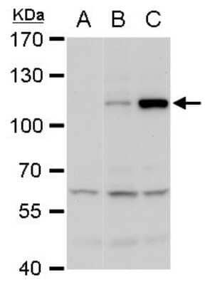 Western Blot: Dengue Virus NS5 Antibody [NBP2-42900]