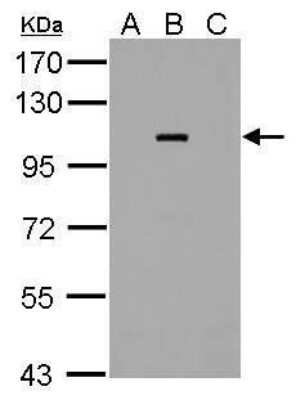 Western Blot: Dengue Virus NS5 Antibody [NBP2-42901]