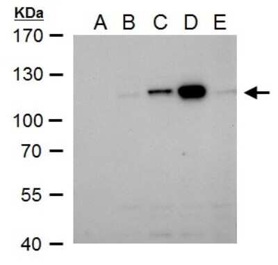 Western Blot: Dengue Virus NS5 Antibody [NBP2-42901]