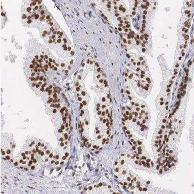 Immunohistochemistry-Paraffin: NSBP1 Antibody [NBP1-87379]