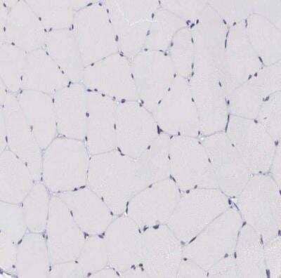 Immunohistochemistry-Paraffin: NSBP1 Antibody [NBP1-87379]