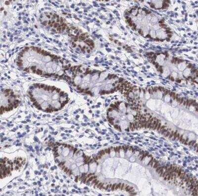 Immunohistochemistry-Paraffin: NSBP1 Antibody [NBP1-87379]