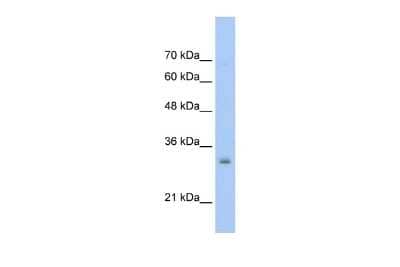 Western Blot: NSBP1 Antibody [NBP2-83290]