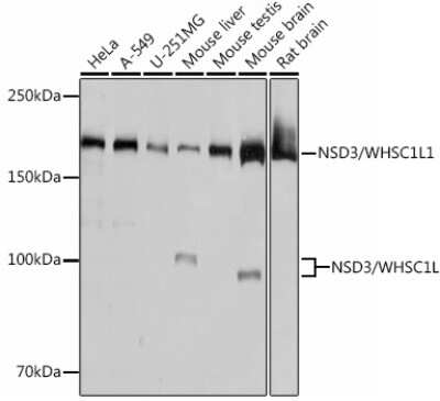 Western Blot: NSD3 Antibody (3U4F9) [NBP3-15449]