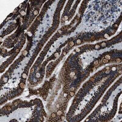 Immunohistochemistry-Paraffin: NSD3 Antibody [NBP1-89851]