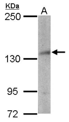 Western Blot: NSD3 Antibody [NBP1-33013]