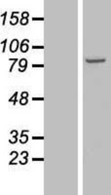 Western Blot: NSD3 Overexpression Lysate [NBP2-06924]