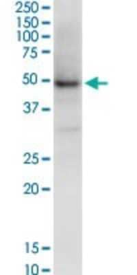 Western Blot: NSDHL Antibody (6E3) [H00050814-M01]