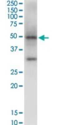 Western Blot: NSDHL Antibody (6E3) [H00050814-M01]