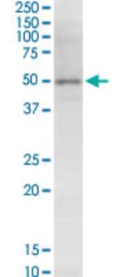 Western Blot: NSDHL Antibody (6E3) [H00050814-M01]