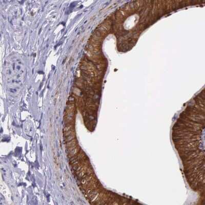 Immunohistochemistry-Paraffin: NSDHL Antibody [NBP1-83306]