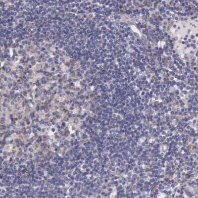 Immunohistochemistry-Paraffin: NSDHL Antibody [NBP1-83306]
