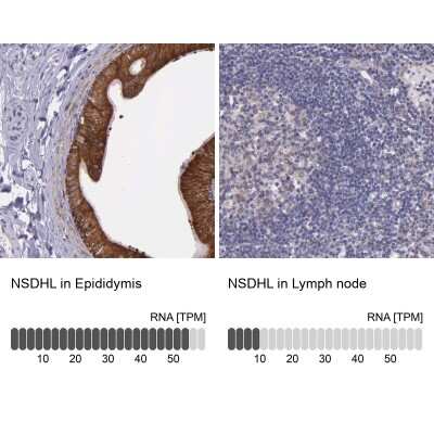 Immunohistochemistry-Paraffin: NSDHL Antibody [NBP1-83306]