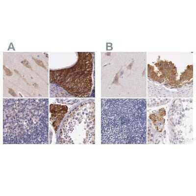 Immunohistochemistry-Paraffin: NSDHL Antibody [NBP1-83306]