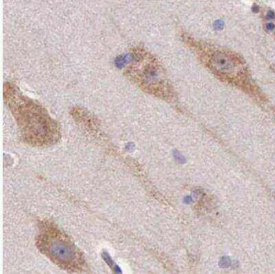Immunohistochemistry-Paraffin: NSDHL Antibody [NBP1-83306]