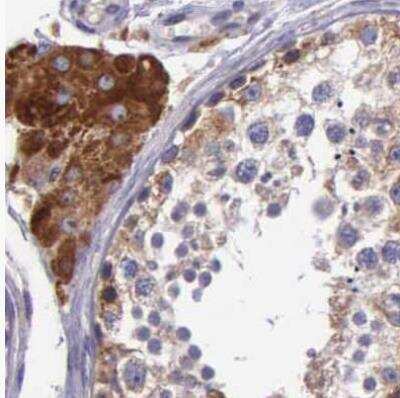 Immunohistochemistry-Paraffin: NSDHL Antibody [NBP1-83306]