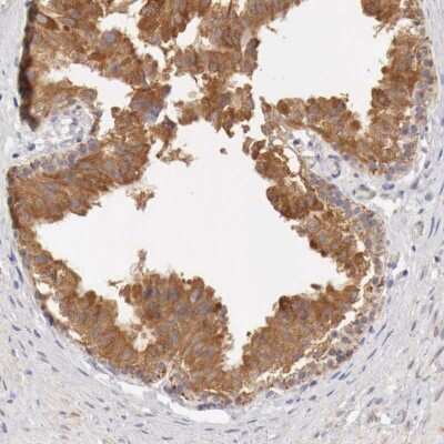 Immunohistochemistry-Paraffin: NSDHL Antibody [NBP1-83307]