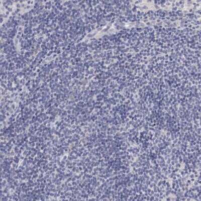 Immunohistochemistry-Paraffin: NSDHL Antibody [NBP1-83307]