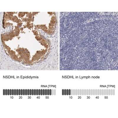 Immunohistochemistry-Paraffin: NSDHL Antibody [NBP1-83307]