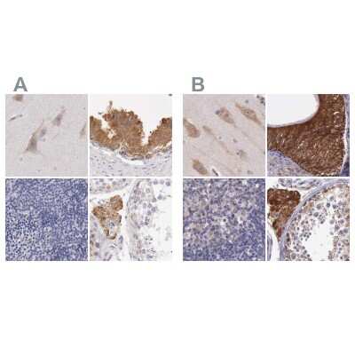 Immunohistochemistry-Paraffin: NSDHL Antibody [NBP1-83307]