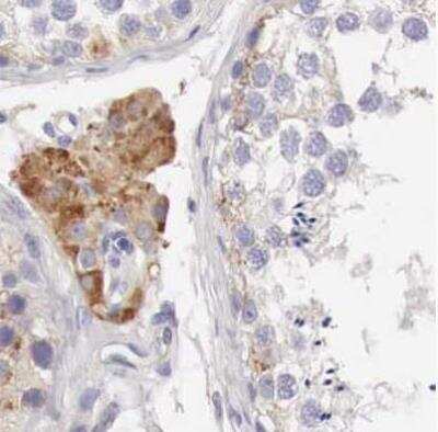 Immunohistochemistry-Paraffin: NSDHL Antibody [NBP1-83307]