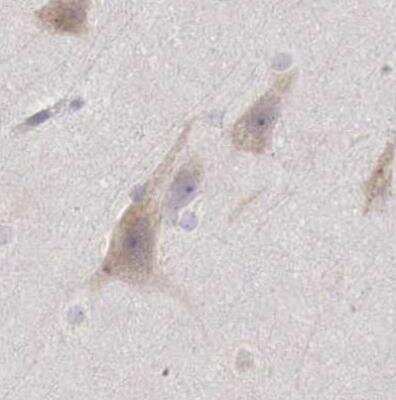 Immunohistochemistry-Paraffin: NSDHL Antibody [NBP1-83307]