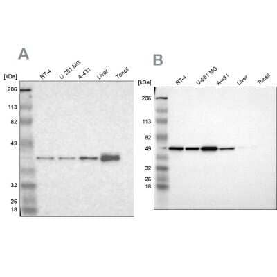 Western Blot: NSDHL Antibody [NBP1-83306]