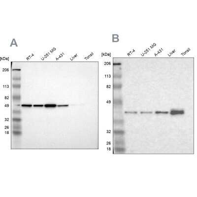 Western Blot: NSDHL Antibody [NBP1-83307]