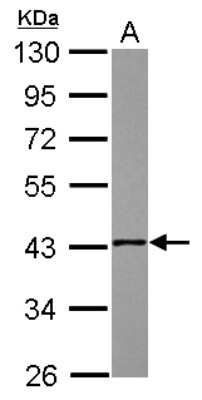 Western Blot: NSDHL Antibody [NBP2-19590]