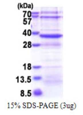 SDS-PAGE: Recombinant Human NSDHL His Protein [NBP2-23258]